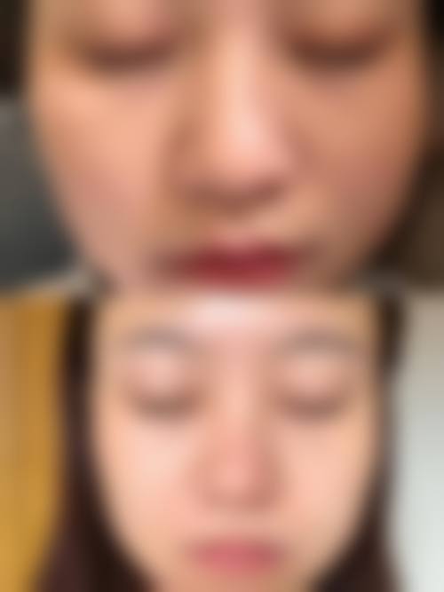 五、北大第一医院激光美容在市场中的竞争力