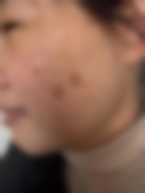 南阳市第三人民医院整形美容科是否正规