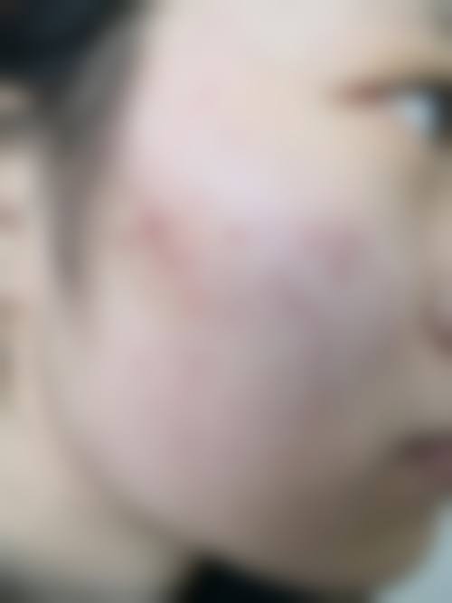 南昌市第四 医院整形科环境和服务如何？