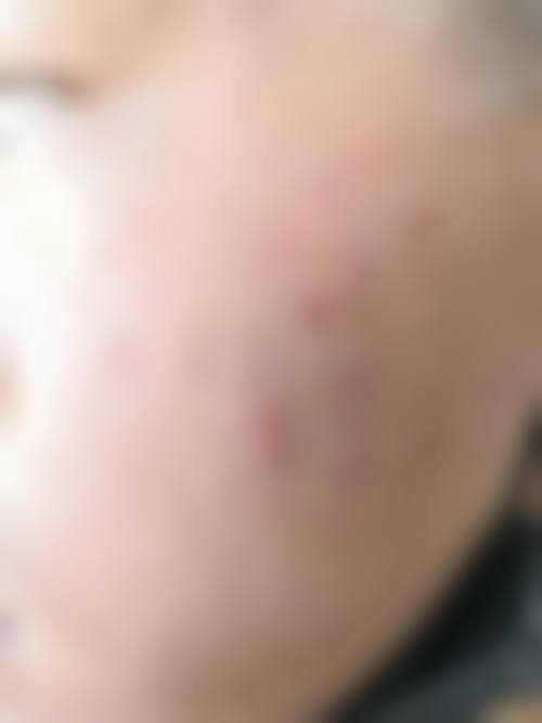 南昌市第四 医院整形科收费贵吗？