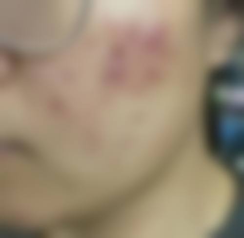 南昌市第四 医院整形科医院擅长什么？