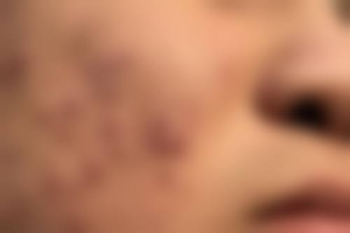 南昌市第四 医院整形科如何预约？