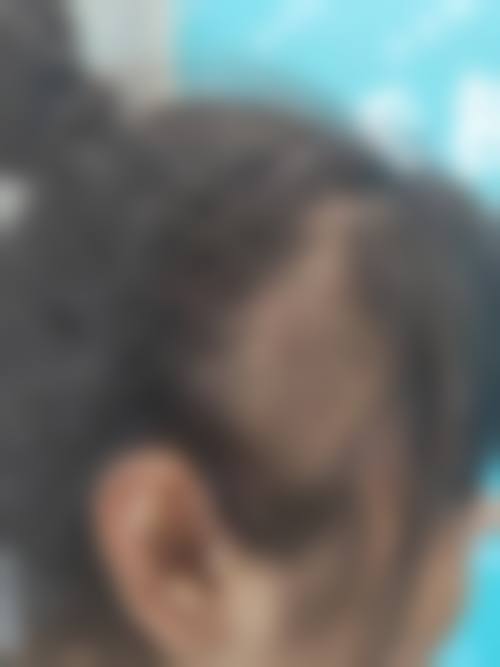 深圳九州丛琳植发的预约方式