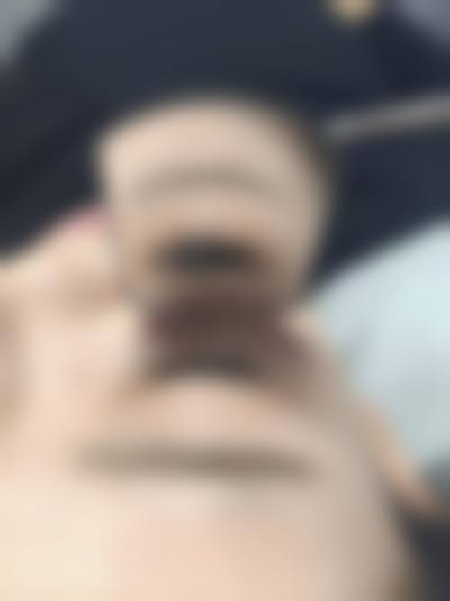 深圳九州丛琳植发的设备优势