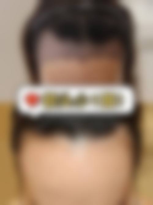 深圳九州丛琳植发的医生团队