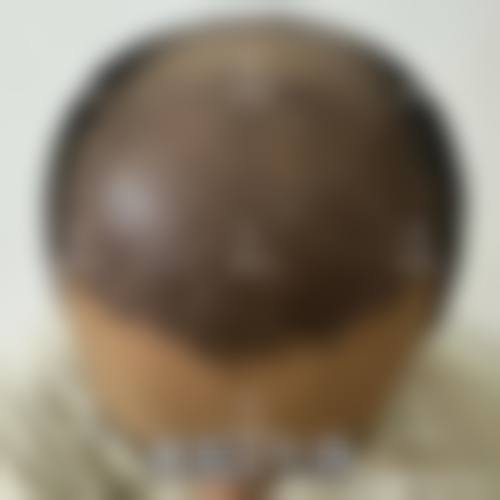 崔允范技术优势