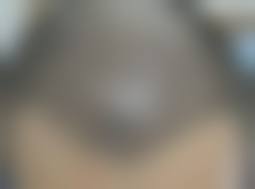 深圳九州丛琳植发的品牌实力