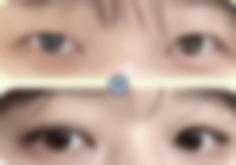 北京协和医院整形外科