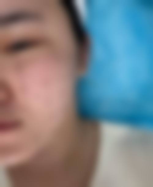 南通椿树上整形医院特色项目及技术优势