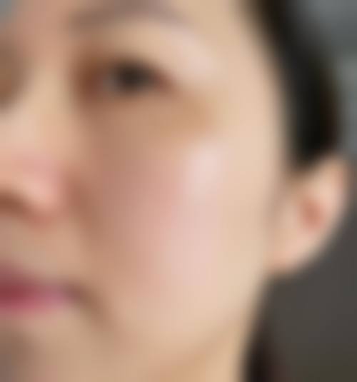 南通椿树上整形医院收费价格表/收费标准