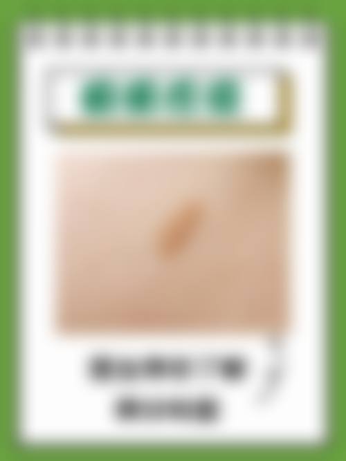 七、不同方法去除疤痕疙瘩的优缺点对比