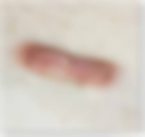 二、药物治疗能快速去除疤痕疙瘩吗？