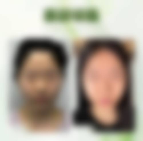南通椿树上整形医院地址电话营业时间