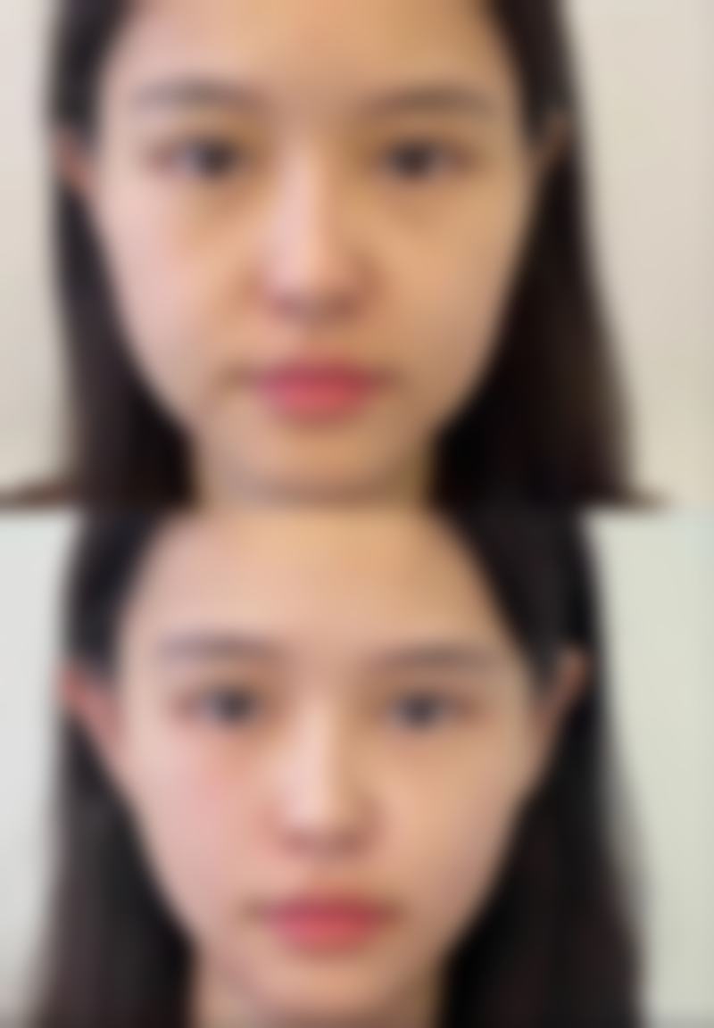 郑州轻莳颜整形医院开展项目范围