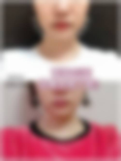 广州医科大学附属第二医院美容科价格表图片：含双眼皮3000-8000元、隆鼻5000-20000元等项目！ 