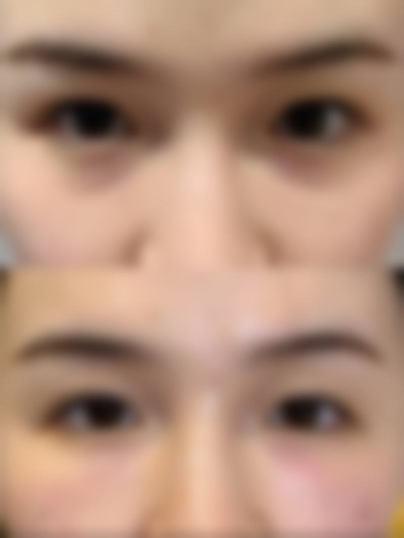 其他常见美容项目价格情况