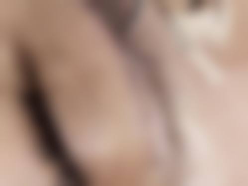 疤痕体质的人能纹眉吗之其他替代方法