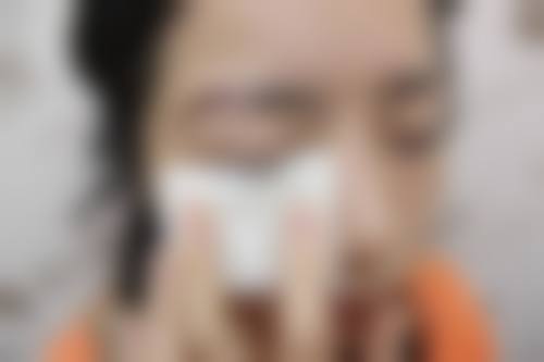 疤痕体质的人能纹眉吗之不建议纹眉的原因