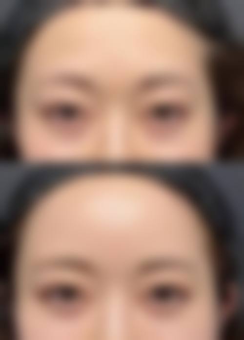 按摩眼部的正确方法