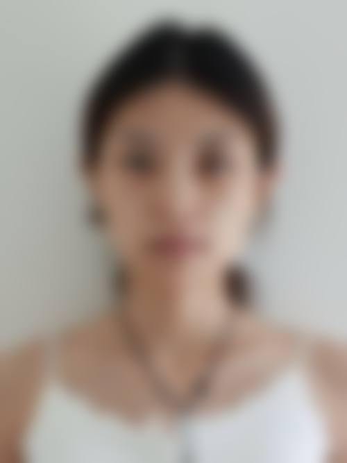 紧致提升：定格青春容颜
