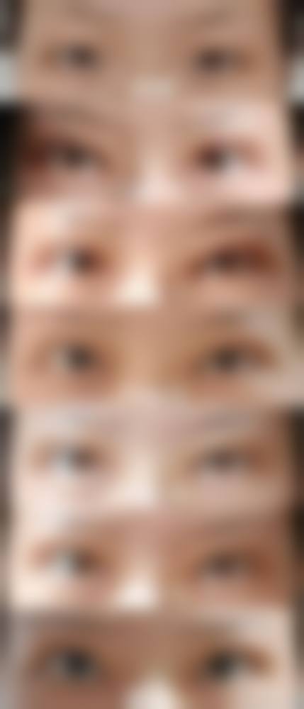 深圳艺美汇医疗美容诊所真人口碑评价怎么样?