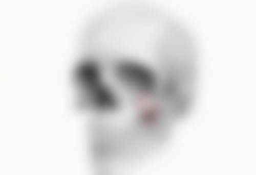 割双眼皮肿胀时间与个人体质