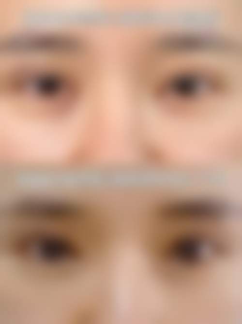 长期跟踪管理