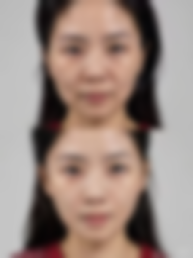 医美项目价格