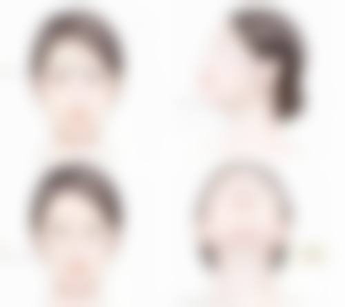割双眼皮上班前的注意事项