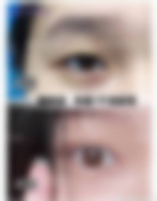 嵩明骨伤美容外科医院特色项目及技术优势