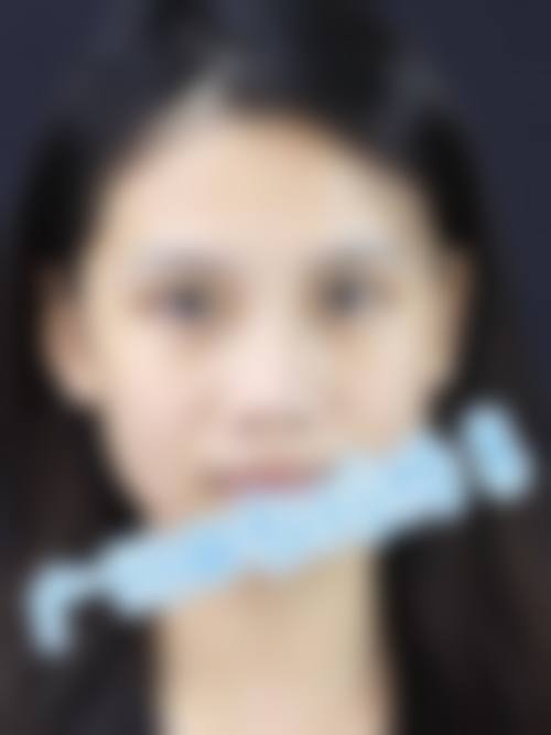 中山大学附属第一医院整形修复外科预约方式