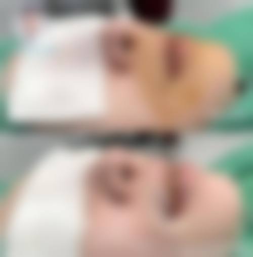 重庆神龙阁整形医院真人口碑评价怎么样?