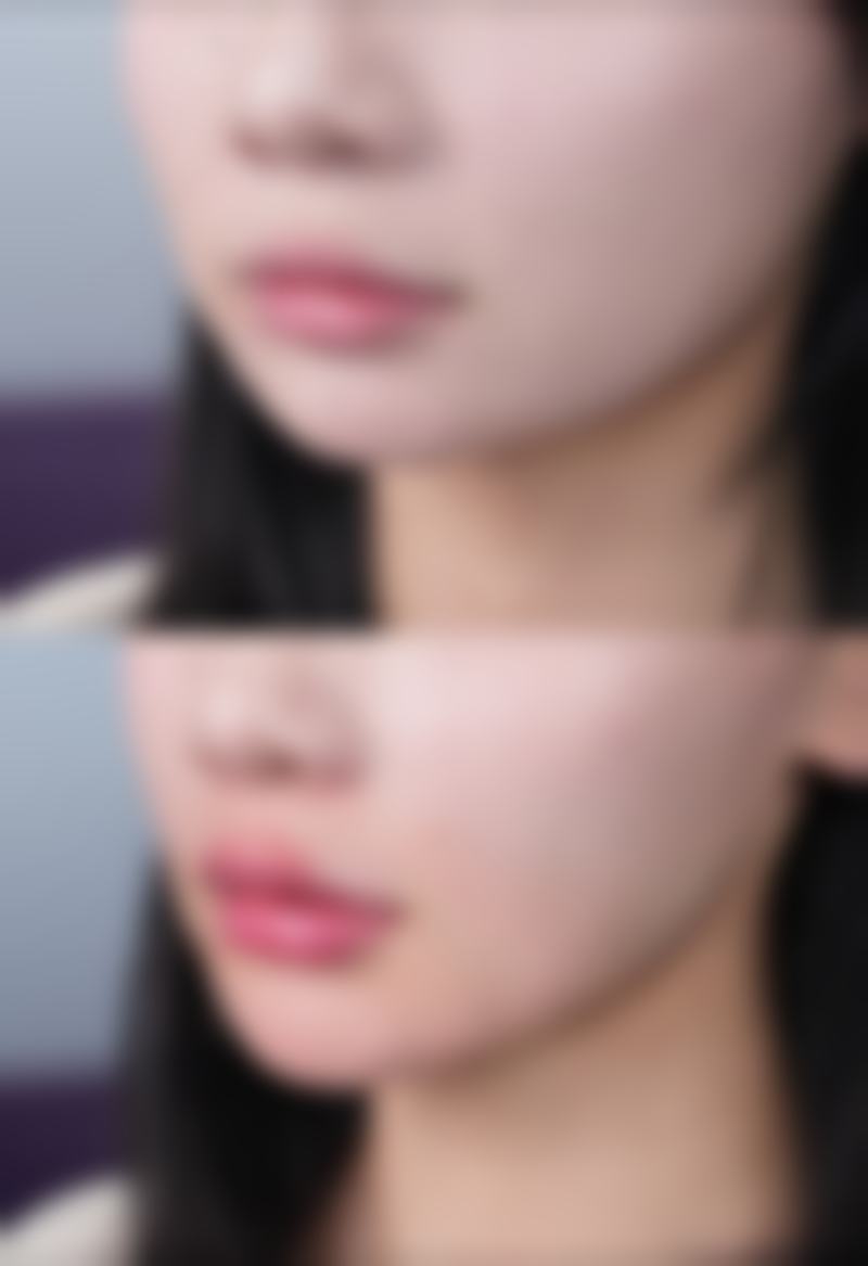 成都做生殖增粗哪个医院好?推荐成都曙光医院，经验丰富技术优，患者口碑良好！ 