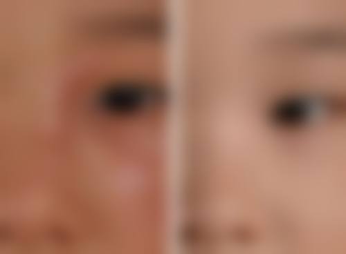 东莞华美医疗美容医院：旗舰级的变得更美圣地
