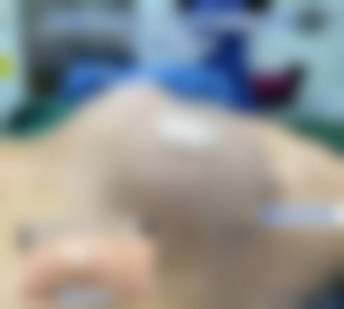 假体隆胸材料对生育的影响