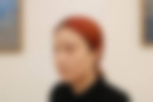 特殊情况对双眼皮第二次修复时间的影响