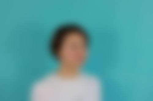 割双眼皮五个月修复的修复过程