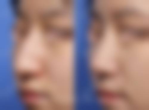 【韩国JN整形外科地址及交通路线】