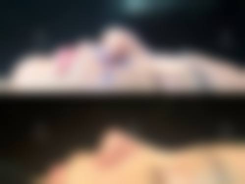 【韩国JN整形外科诊疗项目有哪些】