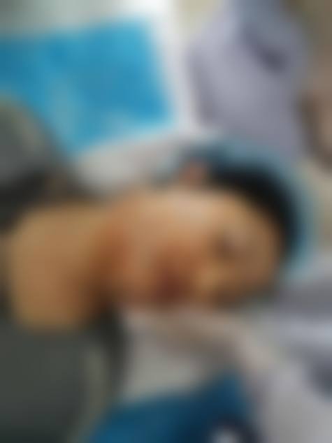 【韩国JN整形外科预约挂号方式】