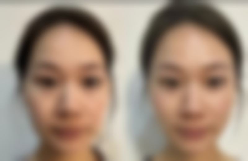 东营芮颜整形医疗医院特色技术及优质服务
