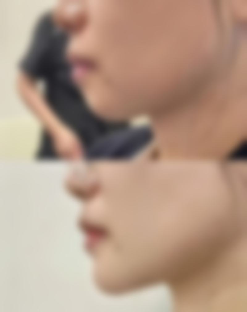 东营芮颜整形医疗患者常见问题解答