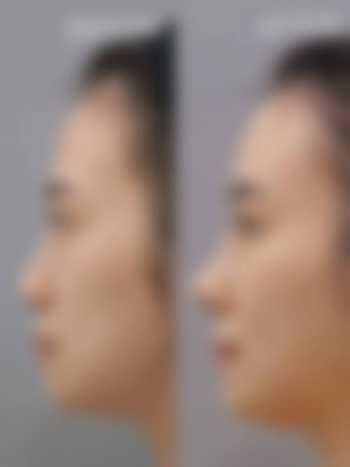 南昌大学医疗美容如何预约？