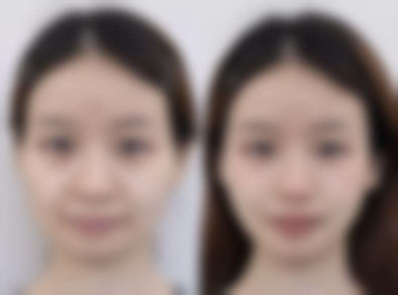 【周口淮海医院整形科技术优势】