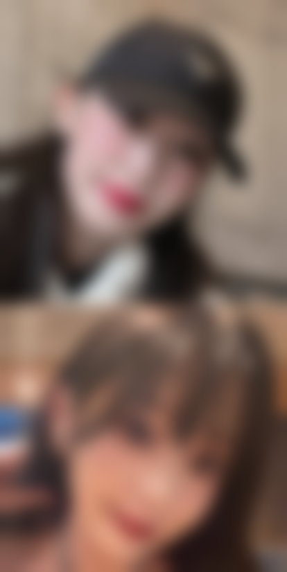 【周口淮海医院整形科口碑与真实评价】