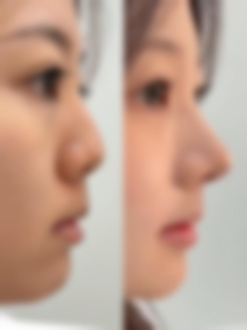 韩国pinkline医院收费价格表/收费标准
