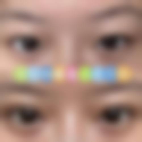 襄阳健桥医院医疗美容科收费标准