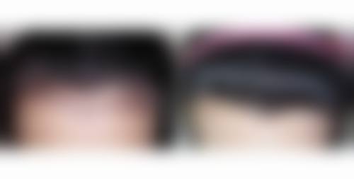 杭州雍禾种植毛发医院的技术优势