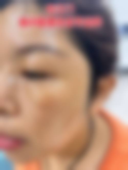 周口市中 心医院整形医院擅长什么？