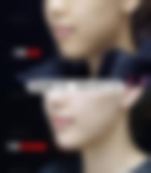 【镇江晶悦整形医疗美容门诊部诊疗项目有哪些】